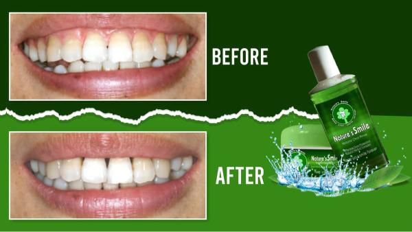 Natures Smile Online